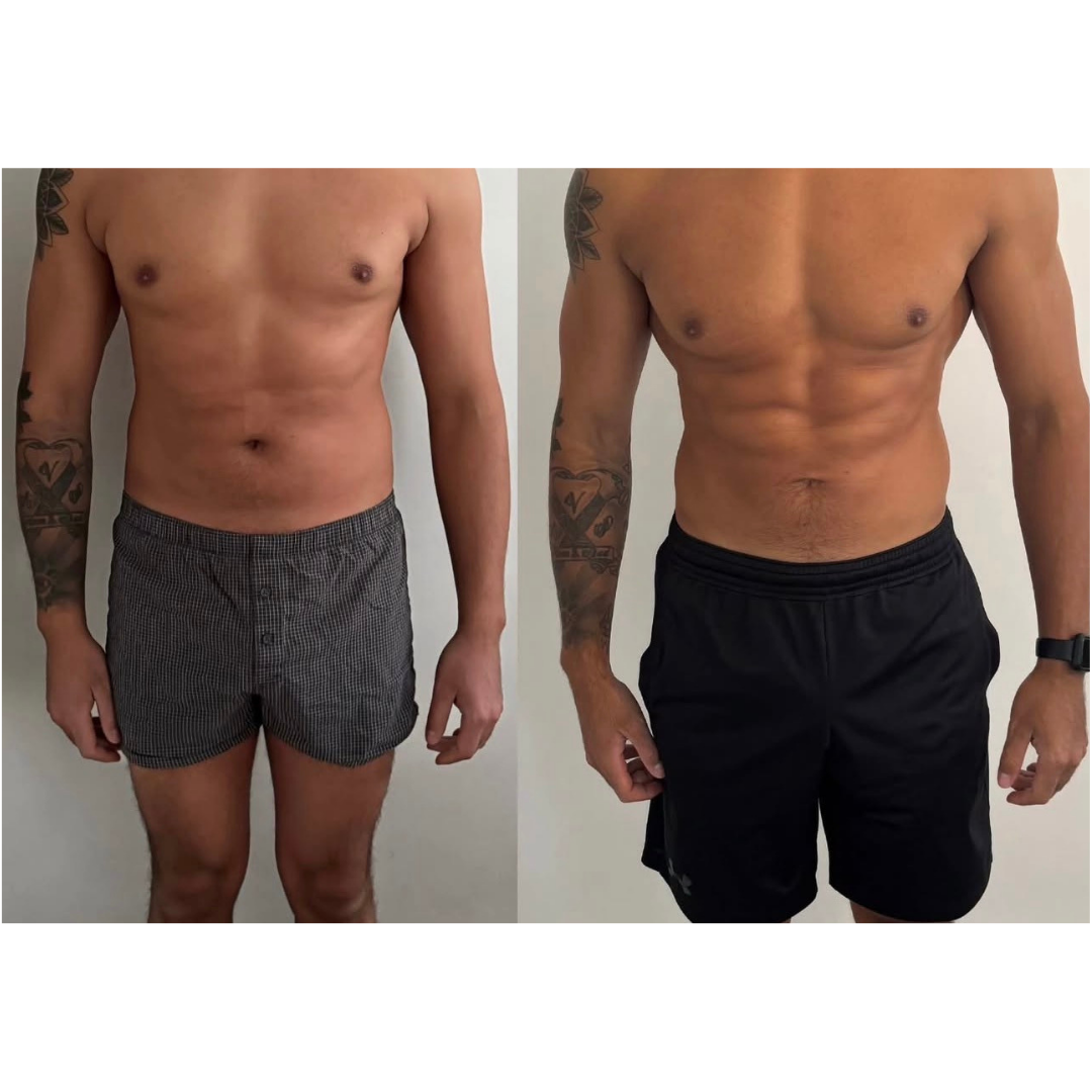 Nutrición clínica deportiva